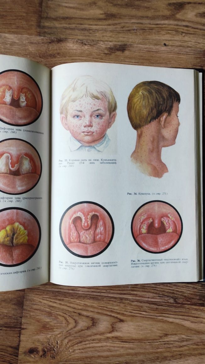 Наукова література Дитячі хвороби