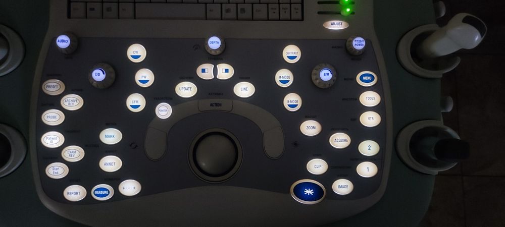 УЗД апарат. Esaote MyLab 40