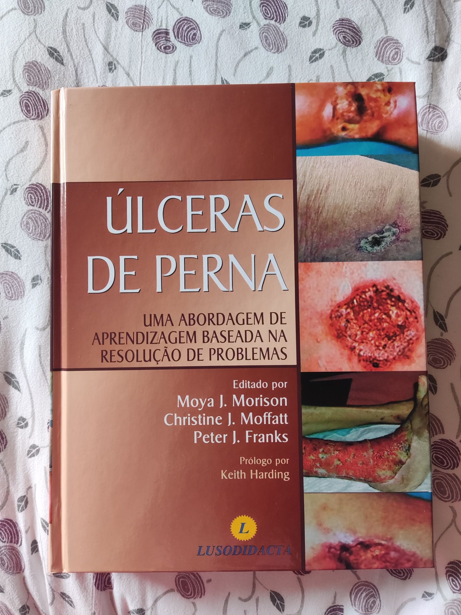 Úlceras de perna