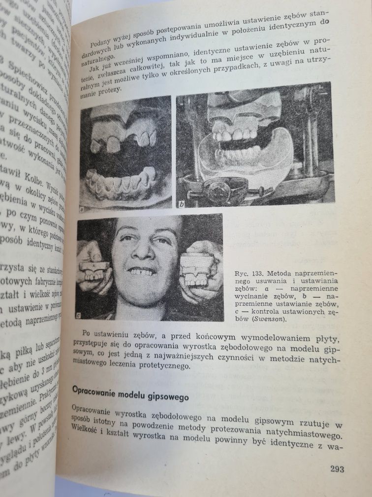 Protetyka stomatologiczna - Eugeniusz Spiechowicz