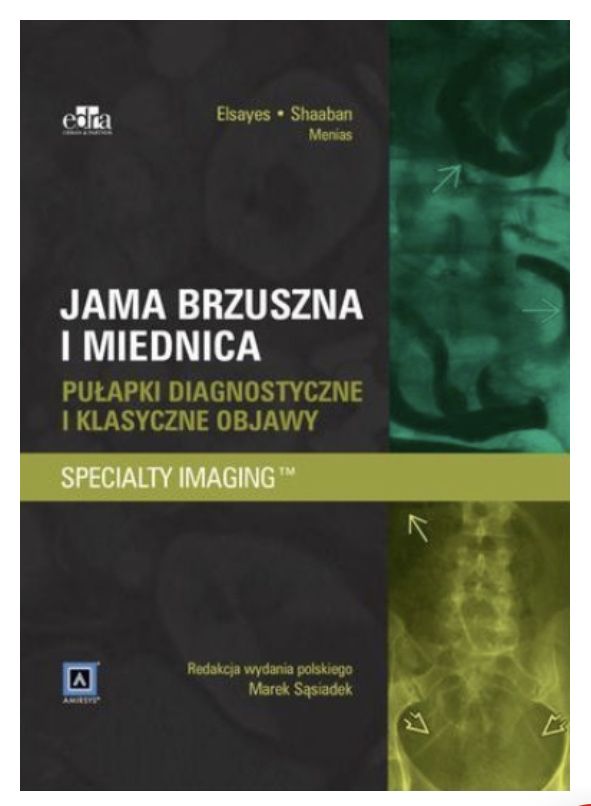 Jama brzuszna i miednica - pułapki diagnostyczne i klasyczne objawy