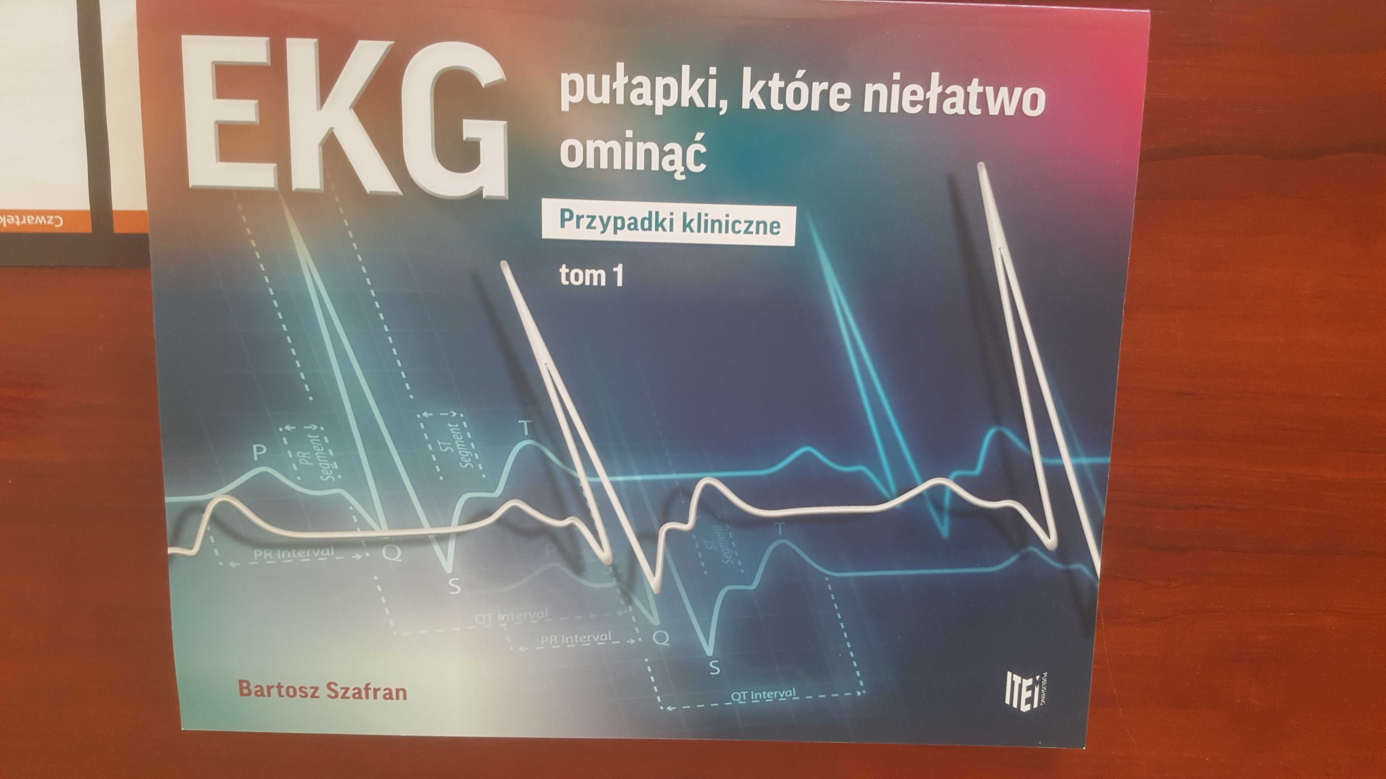 EKG pułapki, które niełatwo ominąć. Tom 1. Bartosz Szafran