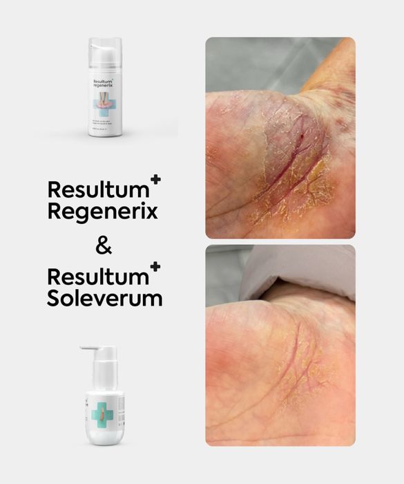 Крем для рук і стоп від тріщин та сухості