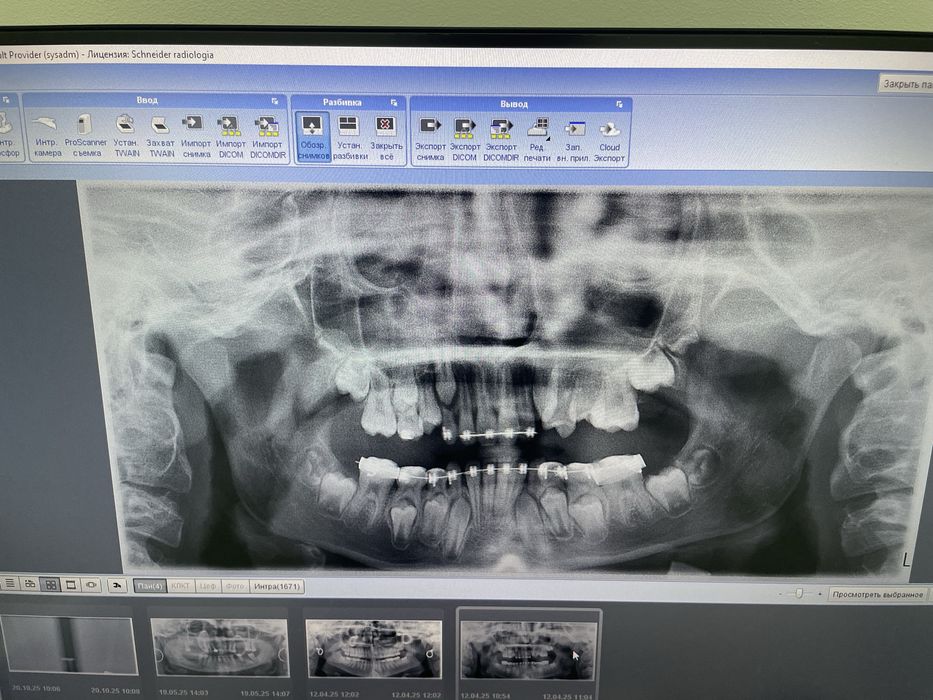 Панорамний рентге Planmeca Proline XC