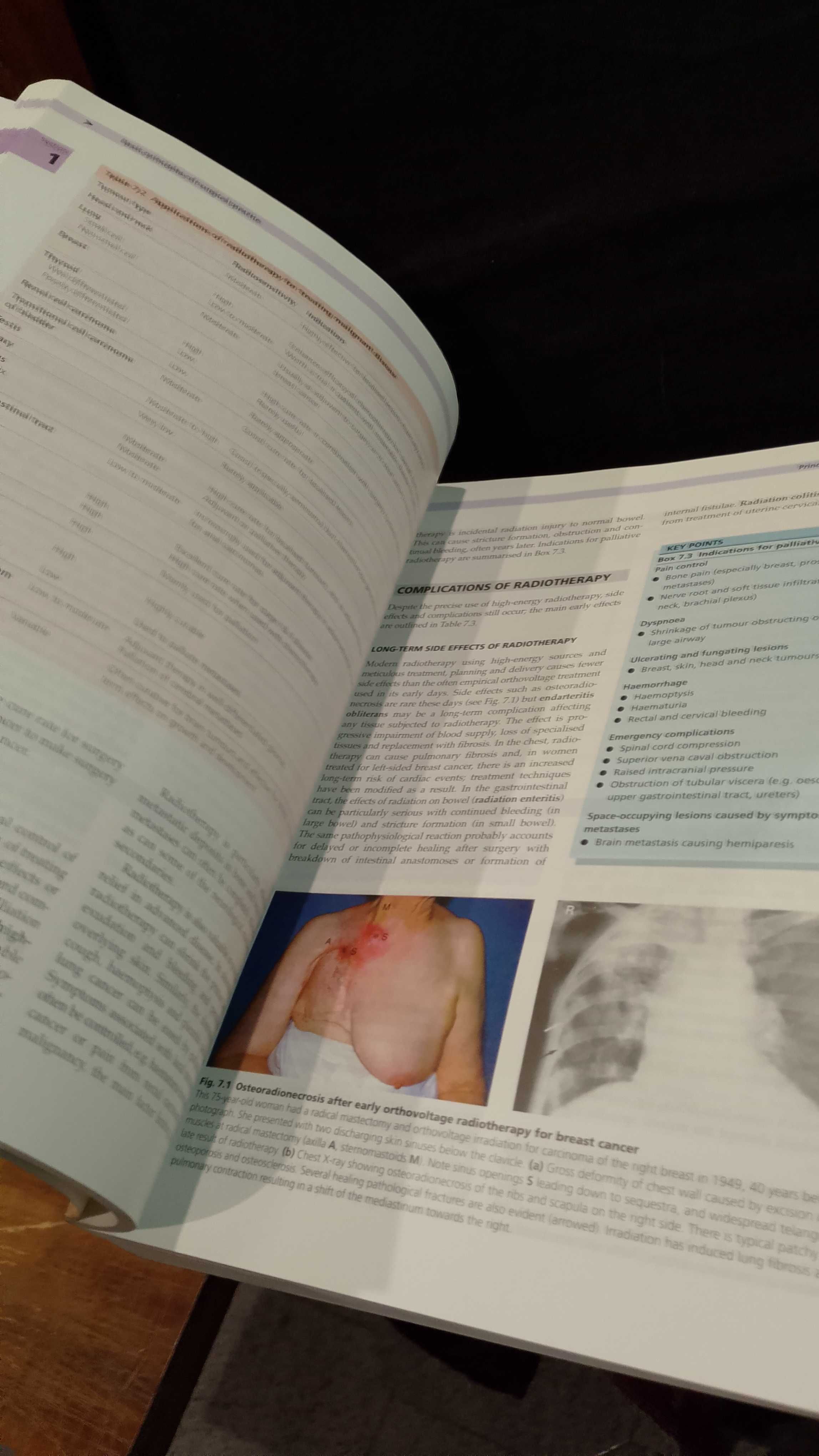 Essential Surgery : Problems, Diagnosis and Management