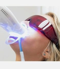 PROMOCJA na Laserowe wybielanie zębów