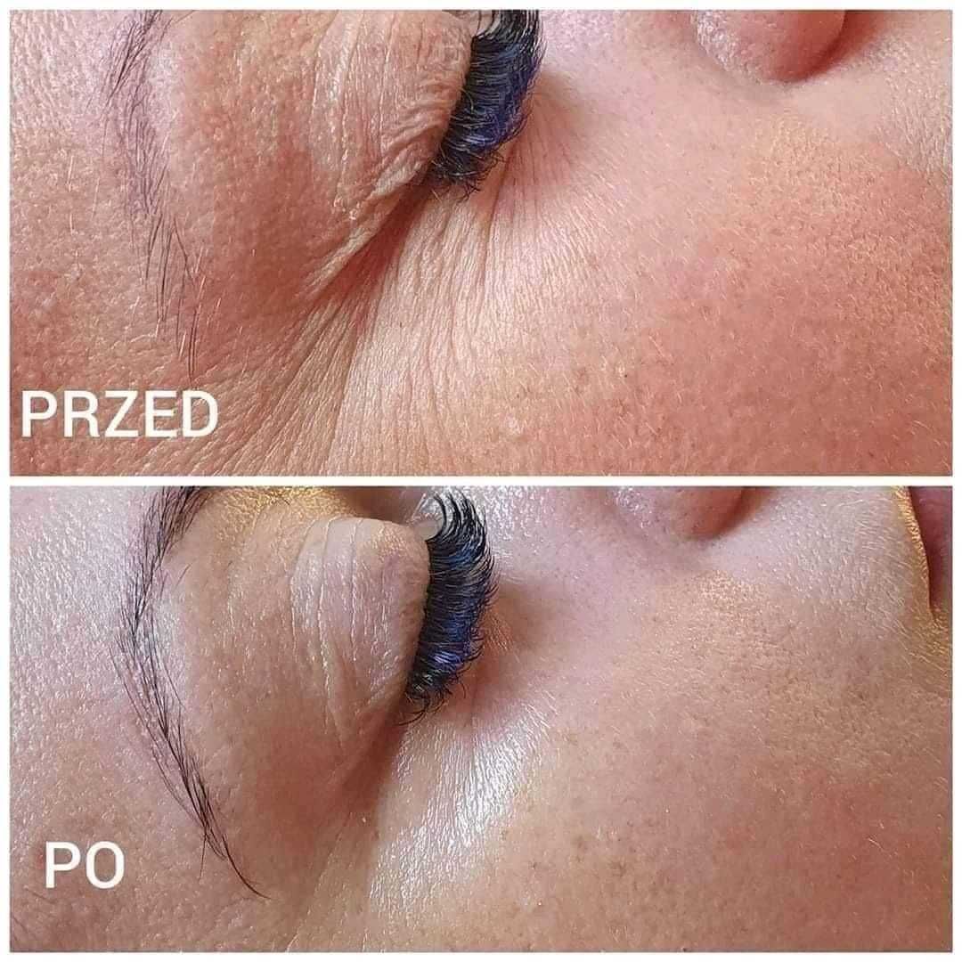 Maski ze złotem Souvre złote maski złoto koloidalne 3 szt lifting glow