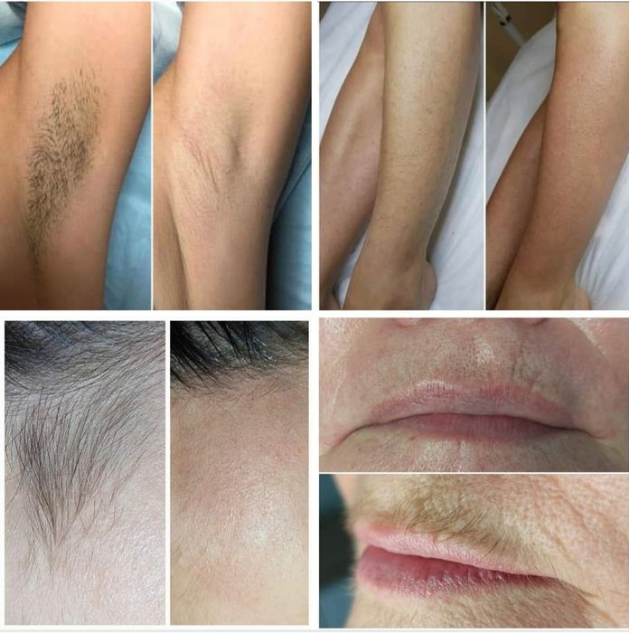 Косметолог,Депіляція шугарінг,оформлення бровей, ламі вій та бровей