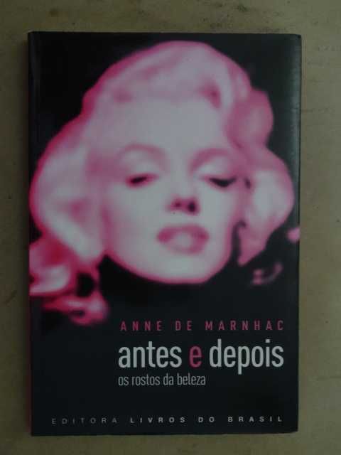 Antes e Depois de Anne de Marnhac - 1ª Edição