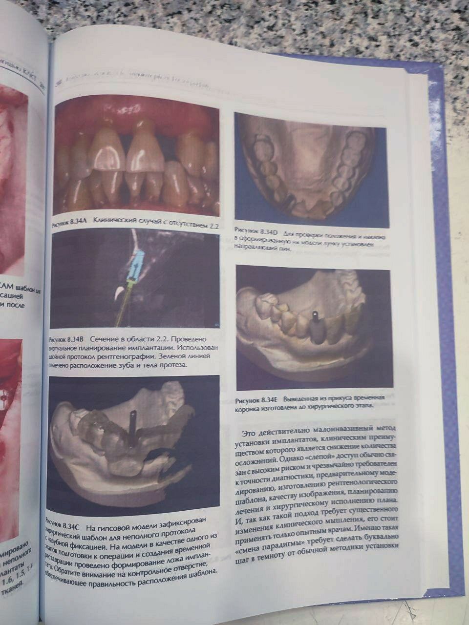 Конусно-лицевая компьютерная томография. Стоматология КТ гнатология