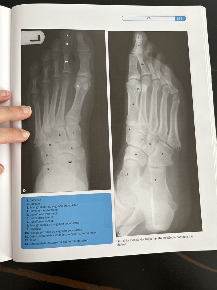 Atlas de Anatomia Humana em Imagem 3ªEdicao