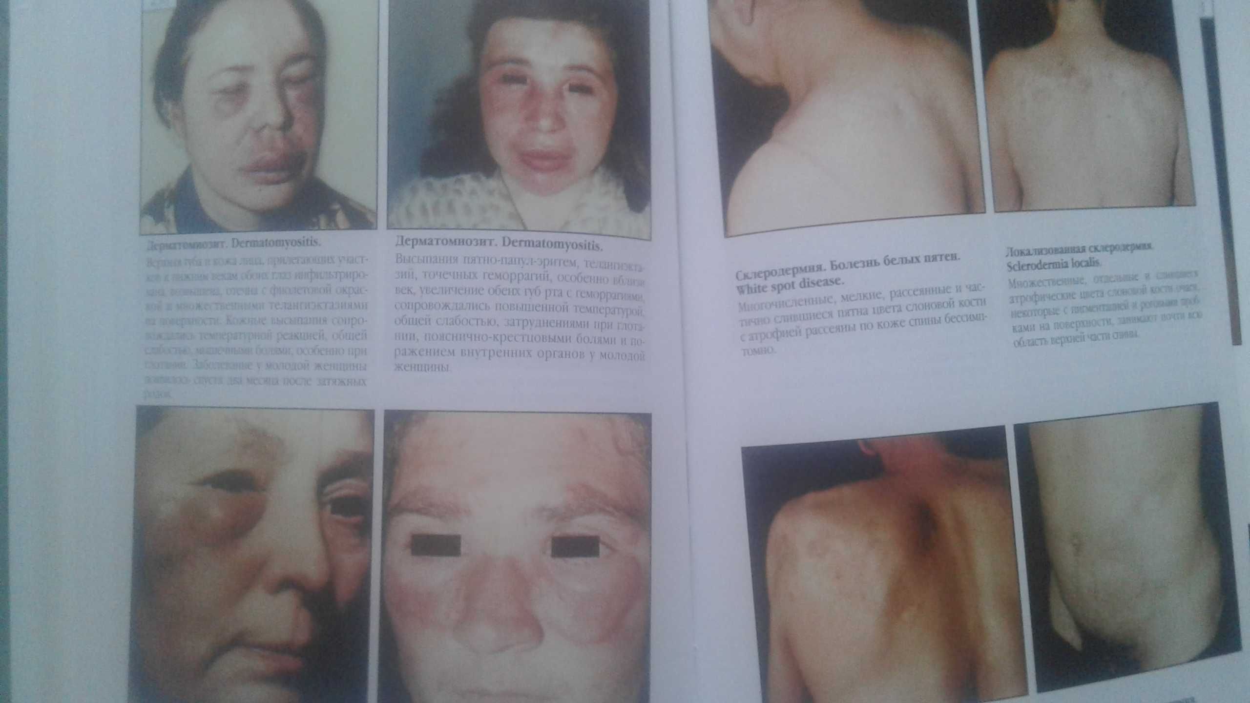 Атлас кожных болезней 2002 год