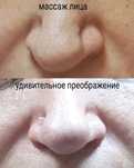Масаж обличчя 3 техніки в одному масажі, міофасціальний, моделюючий, л