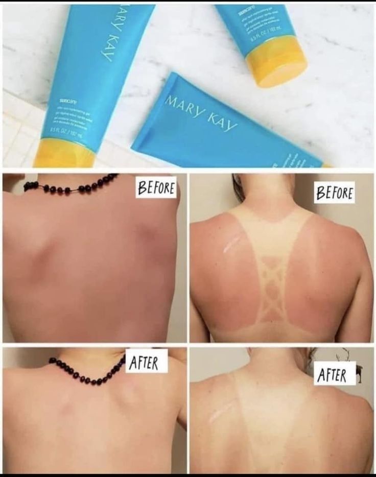 Gel after Sun restaurador