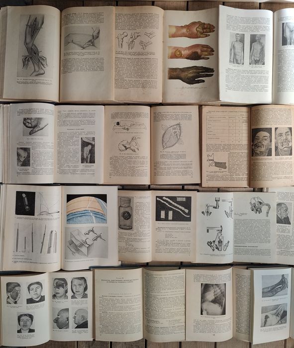 Хирургия Анатомия Пластика Трансплантация органов, тканей, конечностей