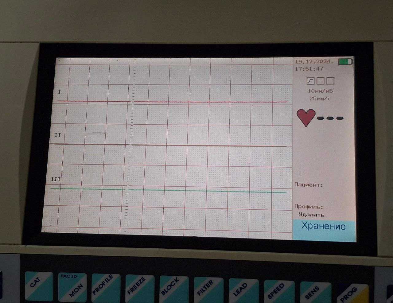 Електрокардіограф Heart Screen Clinic екг кардіограф