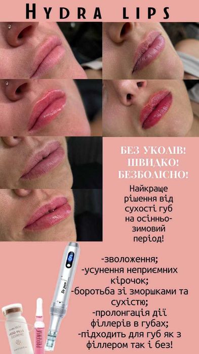 Косметолог,Биоревитализация.  Мезотерапия, Соломʼянка, Київ.