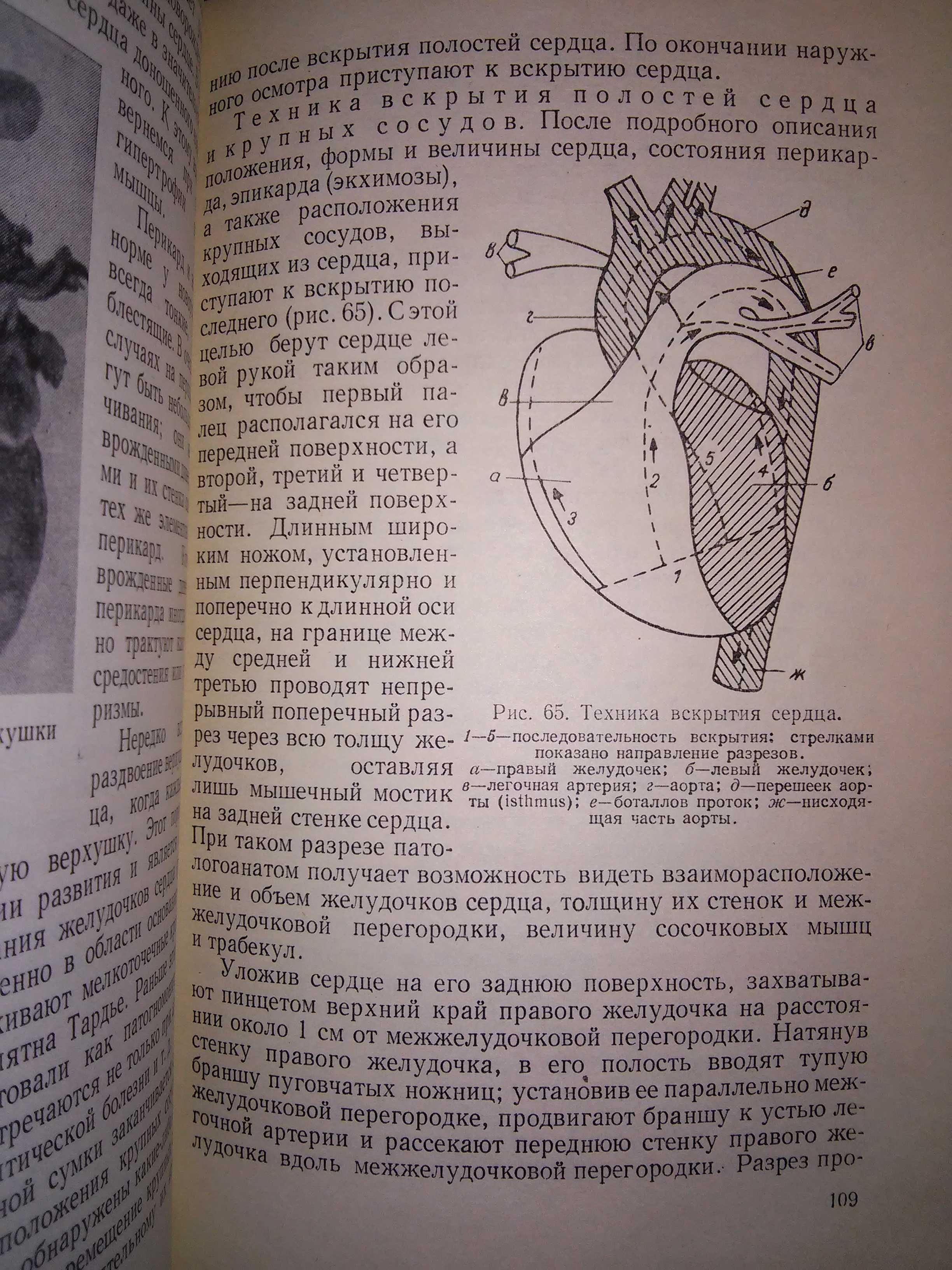 Хрущелевски Секция трупов плодов и новорожденных 1962 р.