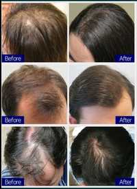 Засіб для відновлення росту волосся