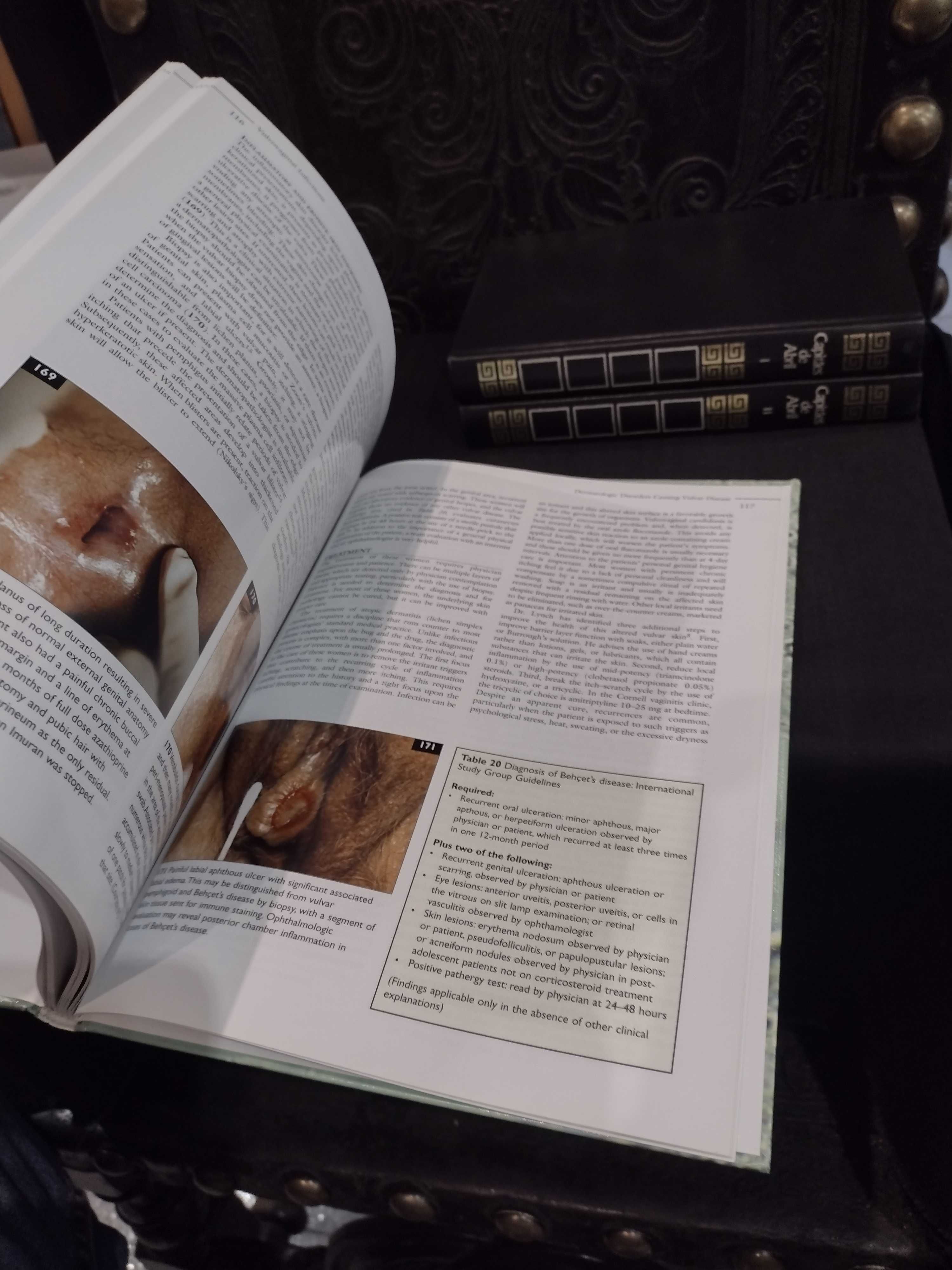 Vulvovaginal Infections - William J. Ledger / Steve S. Witkin