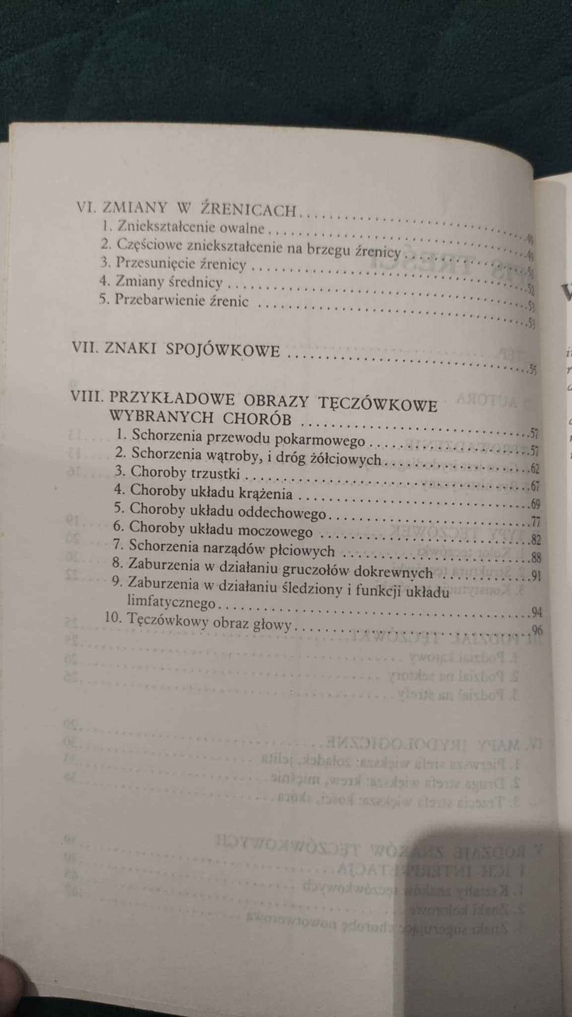 Irydologia Marek Woźniak Irydodiagnostyka