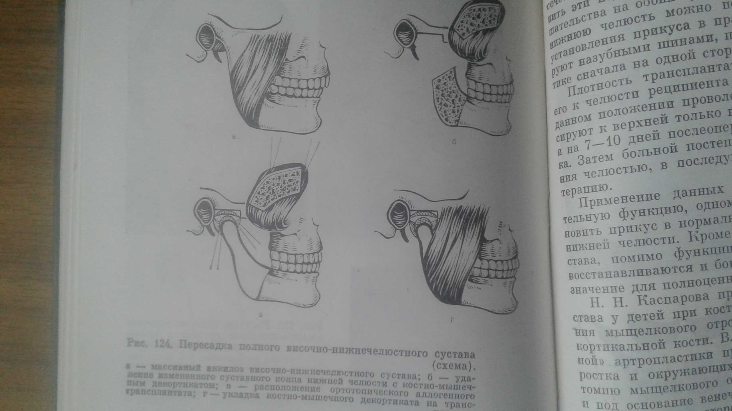 Травмы челюстно-лицевой области 1986 год пластическая хирургия