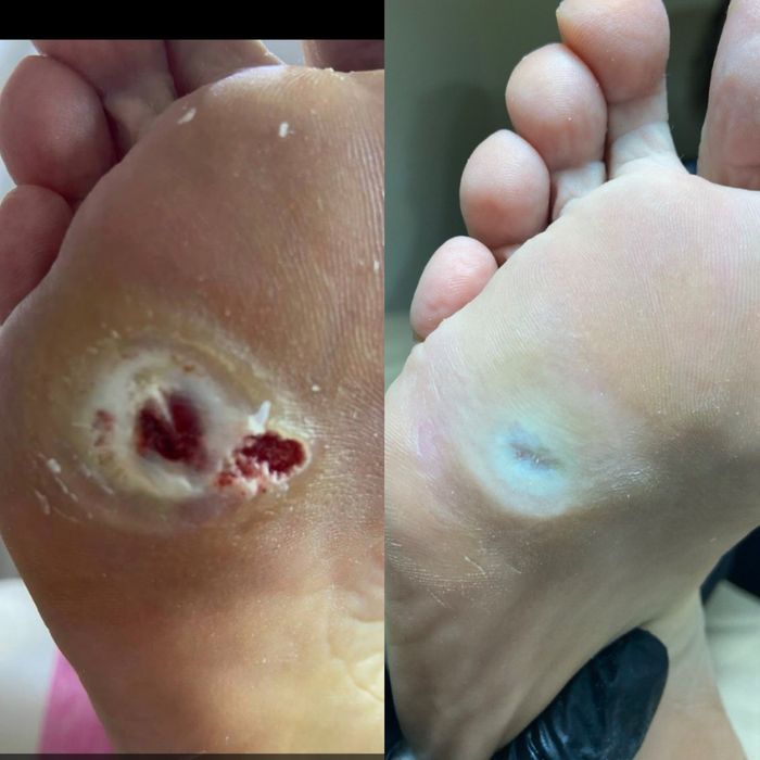 Подолог. Медичний педикюр