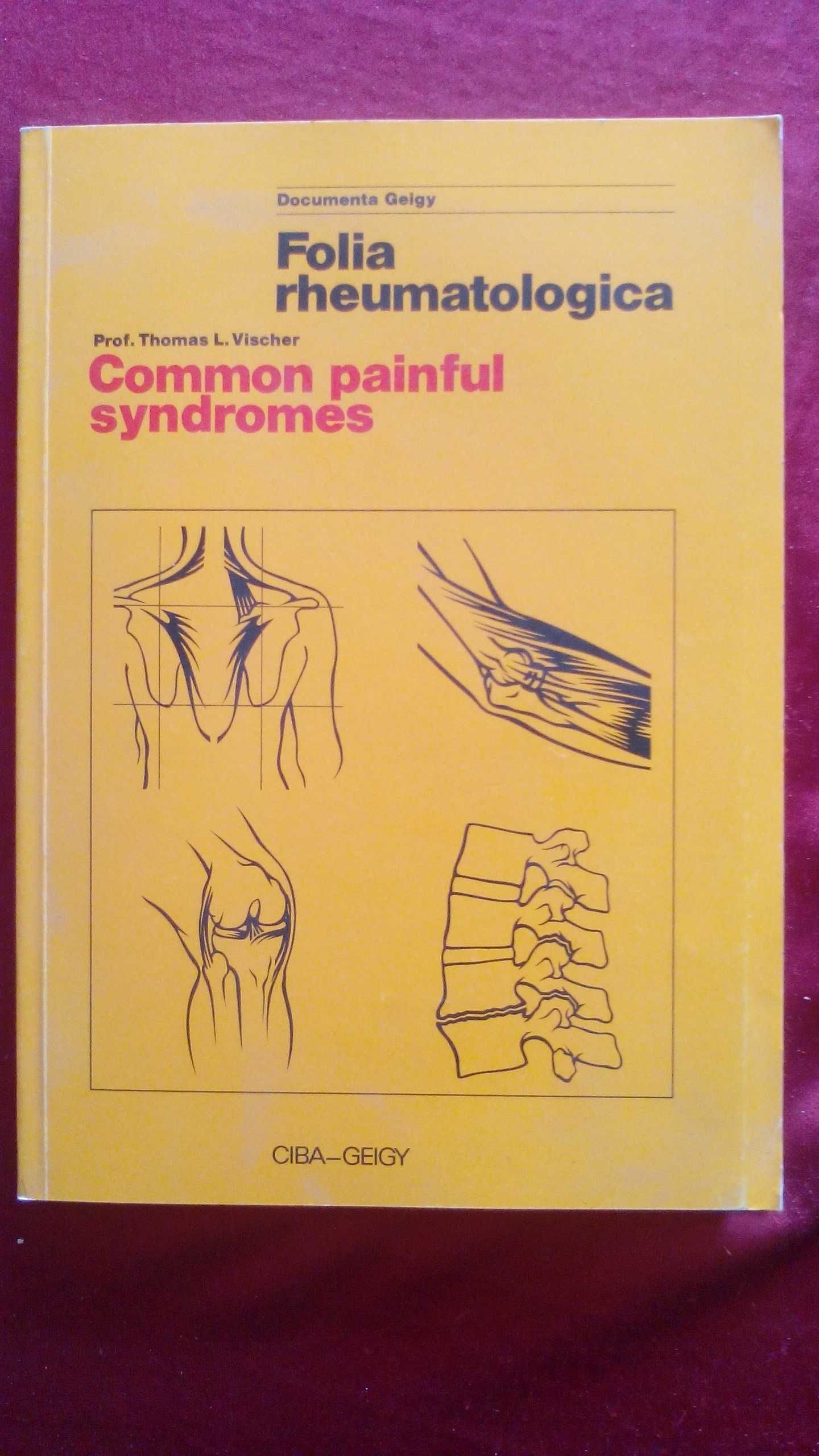 Common Painful Syndromes, de Thomas L. Vischer