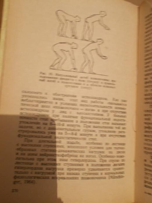 Я.Ю.Попелянский Пельвиомембр.синдромы пояснич. остеохондроза