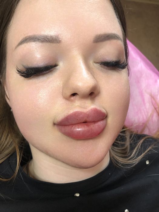 Косметолог - ін’єкціоніст( Тополь,Квартал)