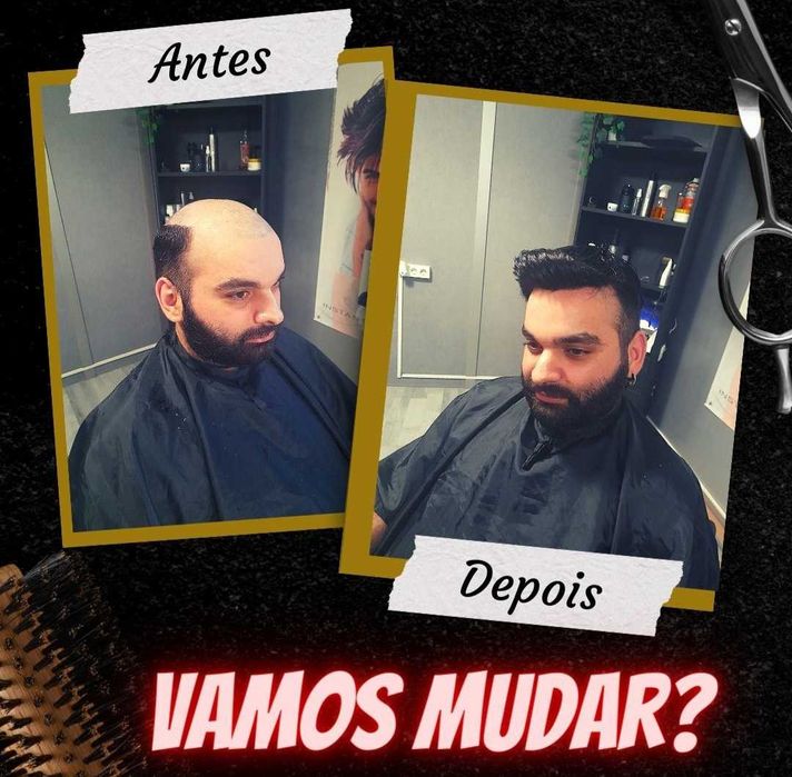 Prótese capilar HD front Lace,  Clínica Justcapilar Lisboa iva incl.