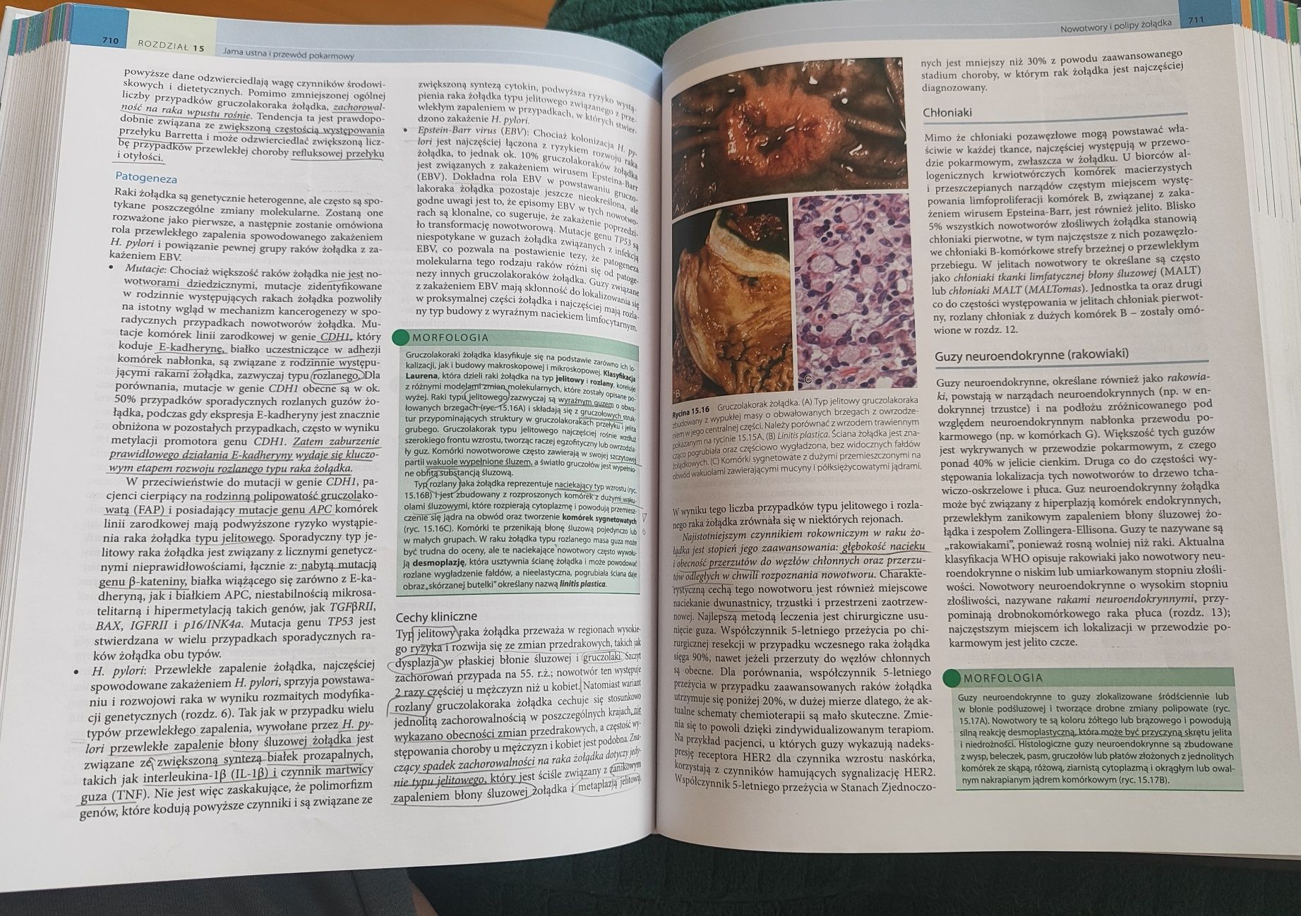 Robbins Patologia Wydanie X
