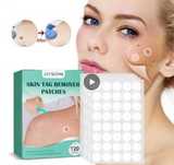 Remover Verrugas - SkinTag