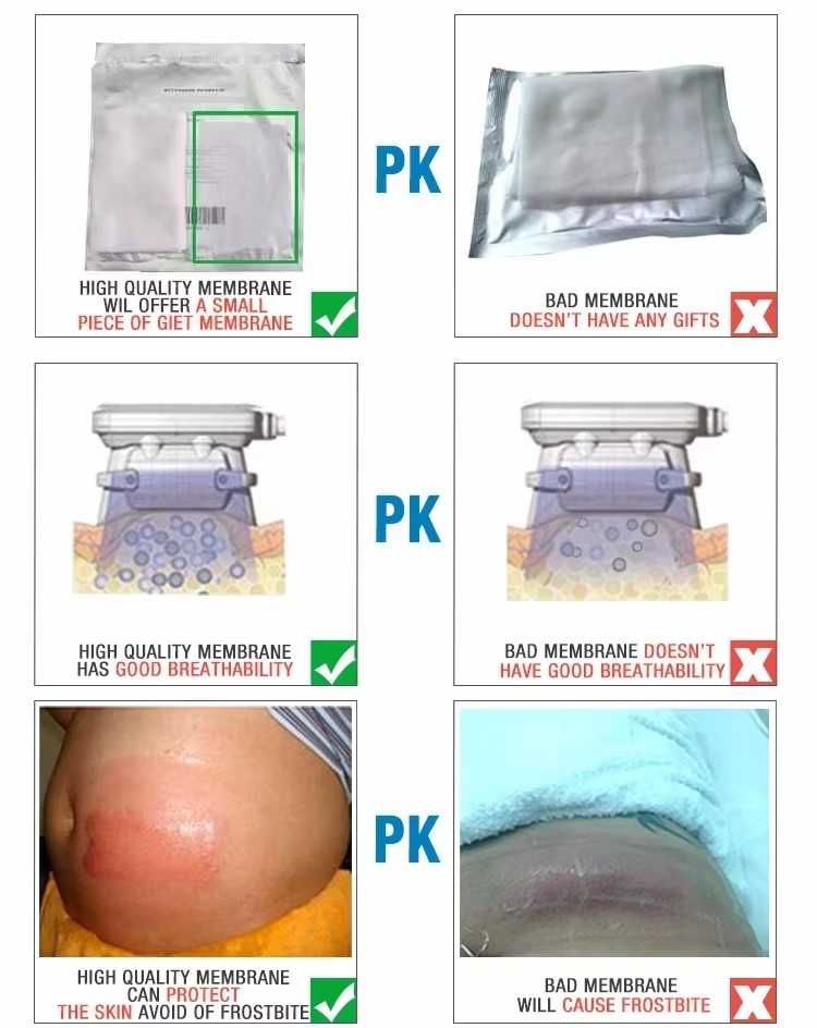 MEMBRANAS PARA CRIOLIPOLISE QUALIDADE 100% GARANTIDA