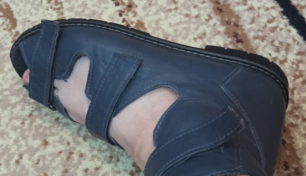 Ортопедичне взуття.