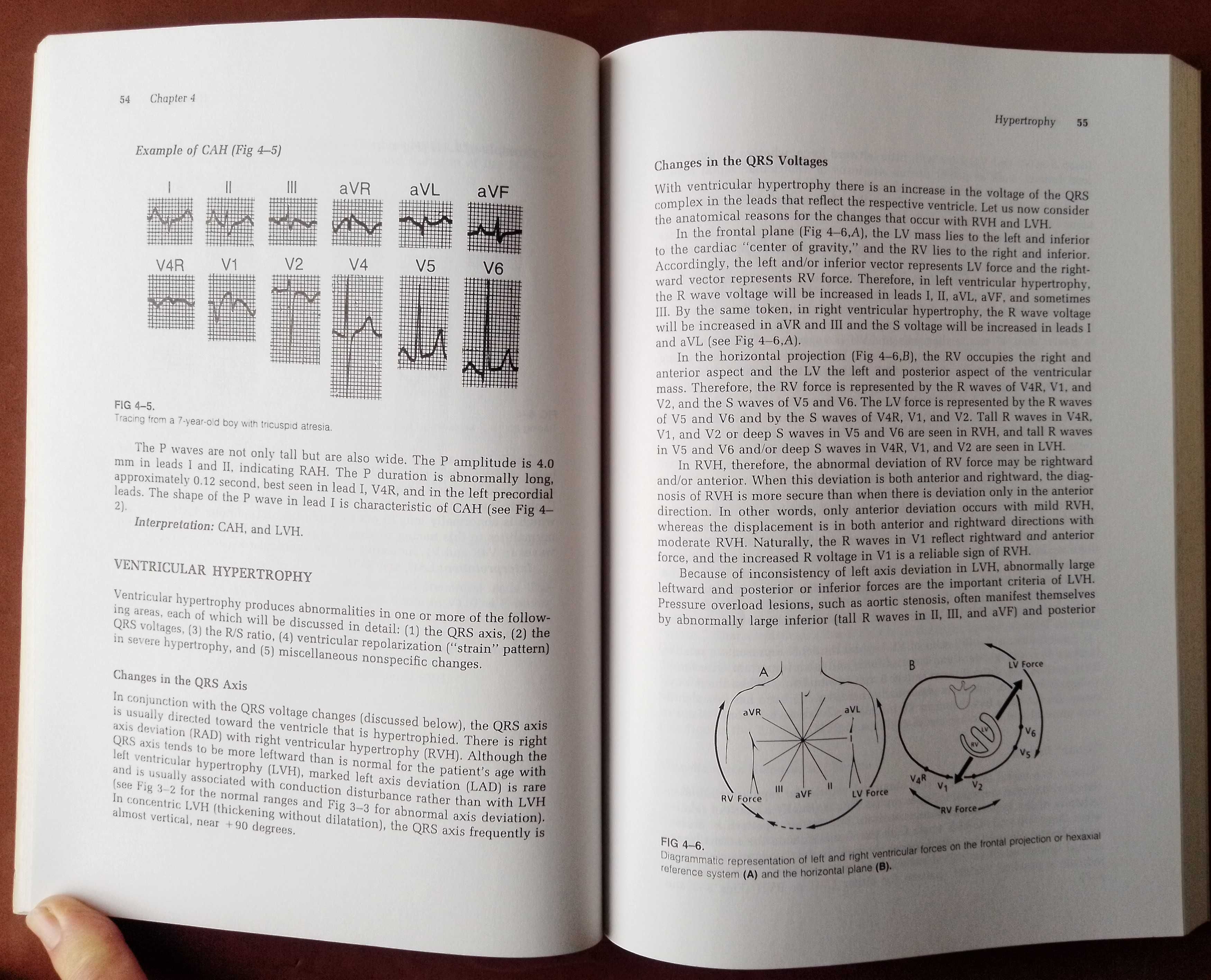 How to read Pediatric ECGs