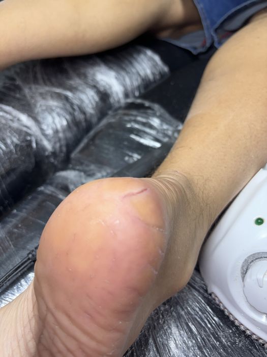 Дмитровка,Горишние плавни ,педекюр