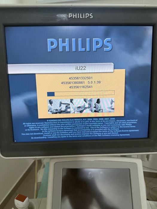 Узд, ультразвуковий апарат Philips iu22