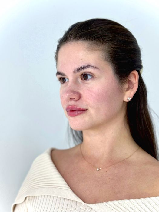 Шукаю моделей на контурну пластику губ,препарати тільки сертифіковані