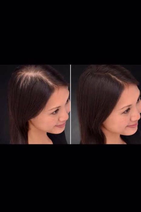 Fibras Toppik para calvície instantâneo