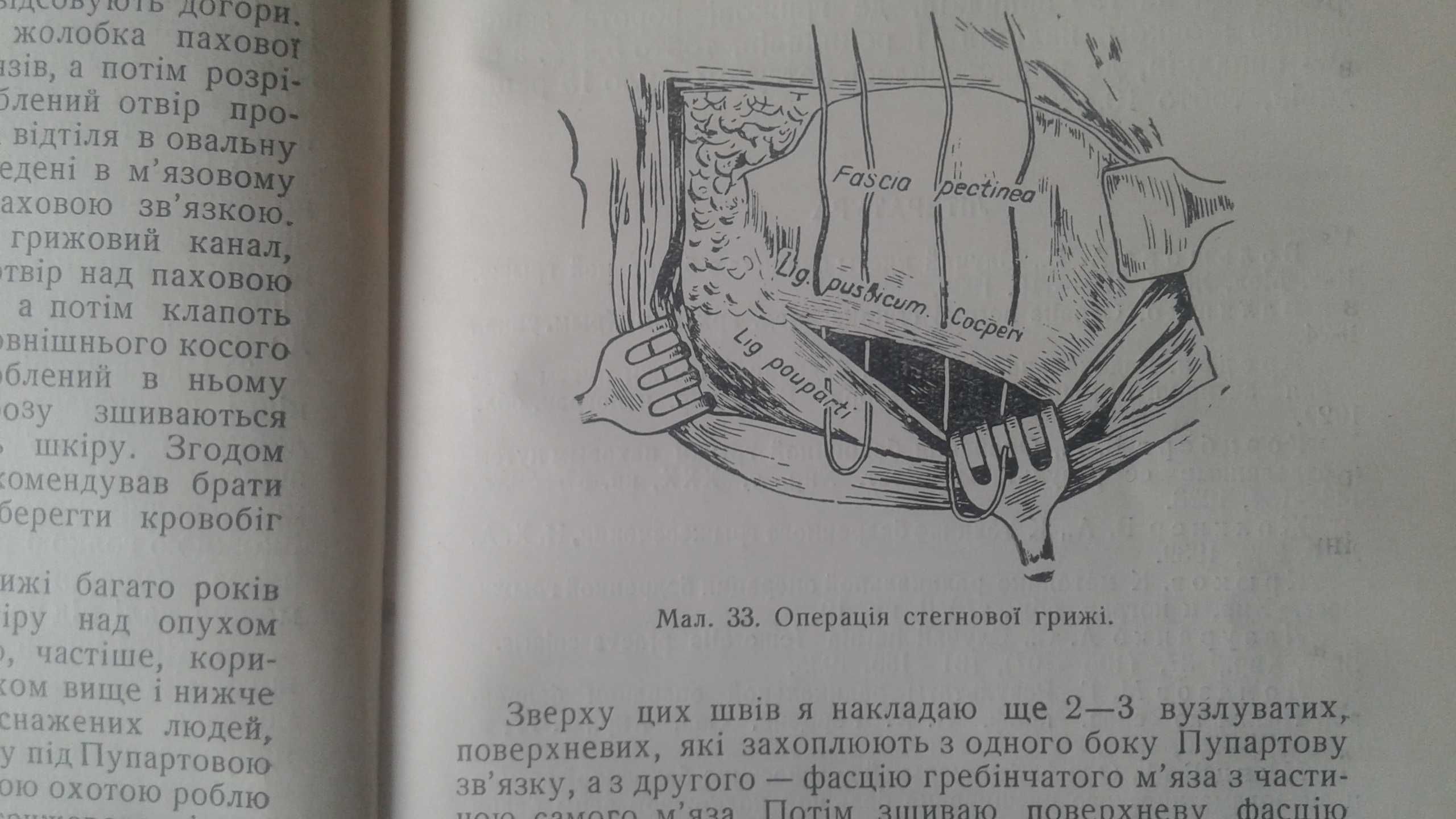 Черевні грижи 1950 рік академік Кримов