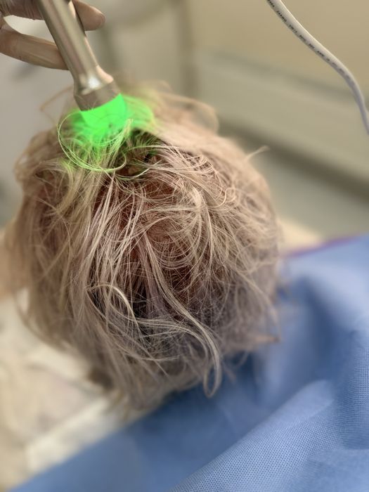 Капельницы.Медсестра с выездом на дом .