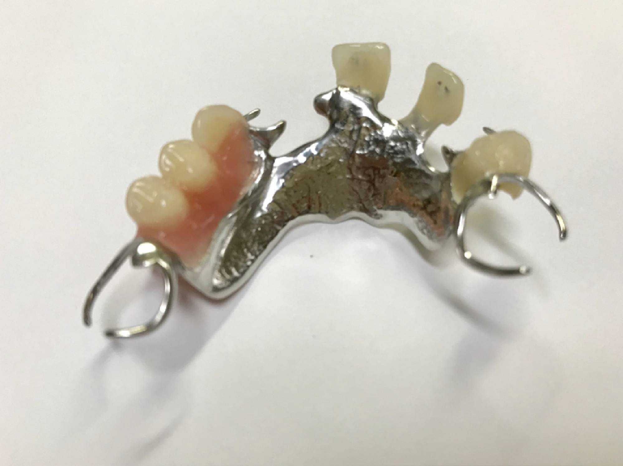 Consertos e fabricação de Prótese Dentária