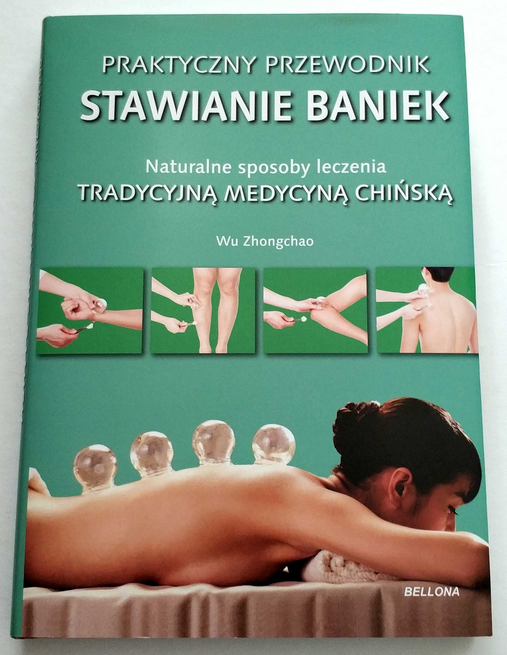 STAWIANIE BANIEK. Tradycyjna Medycyna Chińska, Zhongchao, NOWA!