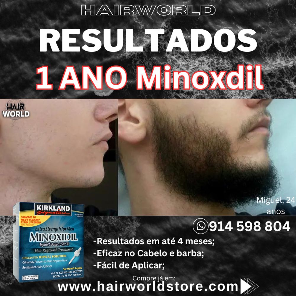 Minoxidil Kirkland a venda em hair world