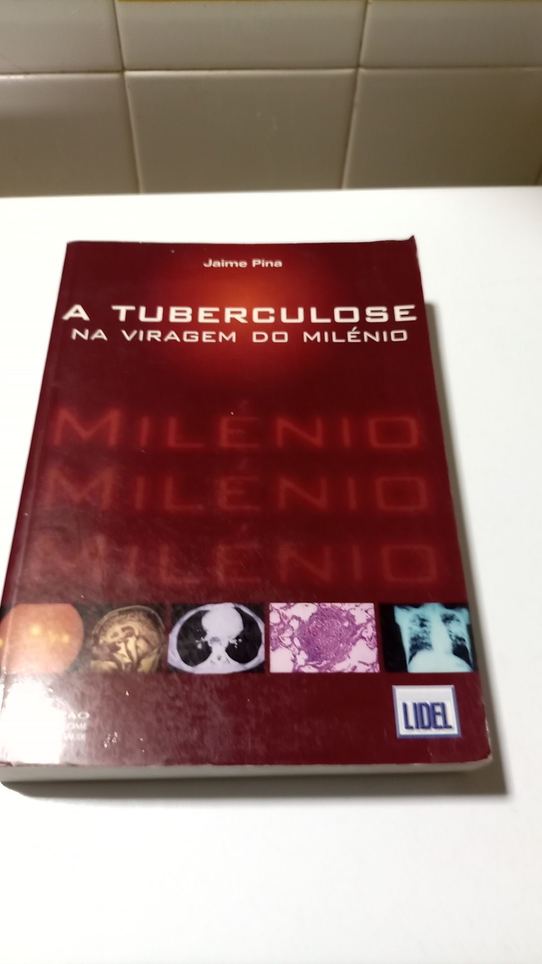 Tuberculose na viragem do milenio de Jaime Pina