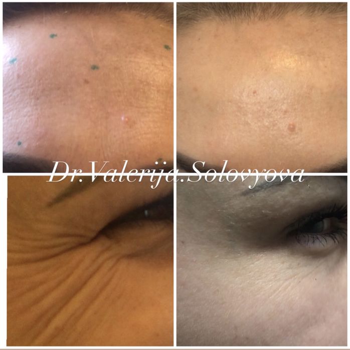 Косметолог Ужгород, інʼєкціоніст.