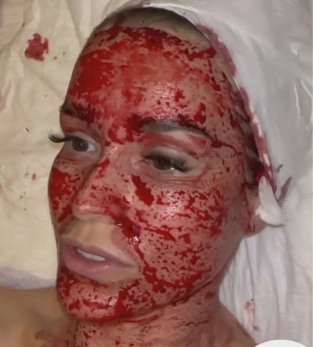 Гирудокосметология Пиявки Ксения Ангерова Мастер класс