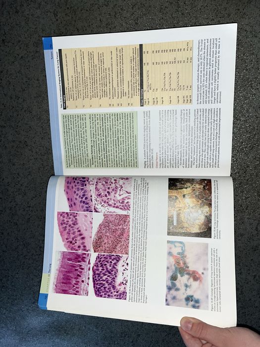 Атлас патології Pathologic basis of disease Robins and Cotran