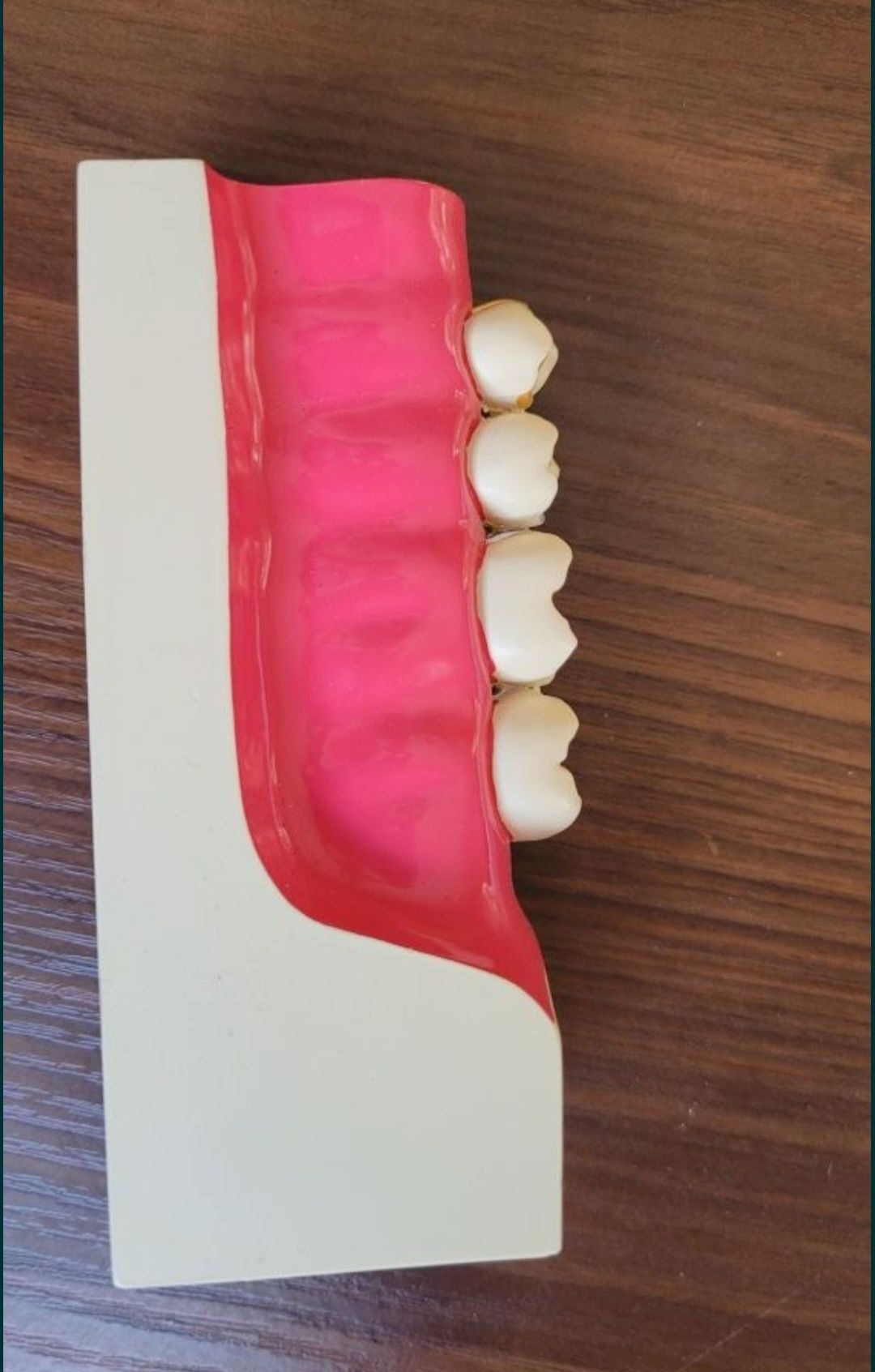 Продам модель кутніх зубів (4зуба)